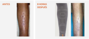 Incrediwear como tecnología innovadora para aliviar el dolor y acelerar la recuperación 4 Captura de pantalla 2023 06 05 134817 | Incrediwear como tecnología innovadora para aliviar el dolor y acelerar la recuperación